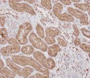 IHC testing of FFPE human kidney tissue with RPS18 antibody. HIER: steam section in pH9 EDTA for 20 min and allow to cool prior to staining.