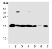 Western blot testing of human 1) U-251 MG, 2) HepG2, 3) ThP-1, 4) Daudi, 5) mouse brain, 6) mouse spleen and 7) rat brain lysate with RPS18 antibody. Predicted molecular weight ~18 kDa.