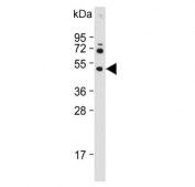 Western blot testing of human HepG2 cell lysate with Hexosaminidase A antibody. Expected molecular weight: ~60 kDa (precursor), ~54 kDa (mature).