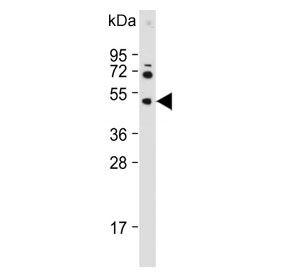 Western blot testing of human HepG2 cell lysate with Hexosaminidase A antibody. Expected molecular weight: ~60 kDa (precursor), ~54 kDa (mature).