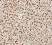 IHC testing of FFPE human liver tissue with Hexosaminidase A antibody. HIER: steam section in pH9 EDTA for 20 min and allow to cool prior to staining.