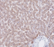 IHC testing of FFPE human liver tissue with CBS antibody. HIER: steam section in pH9 EDTA for 20 min and allow to cool prior to staining.