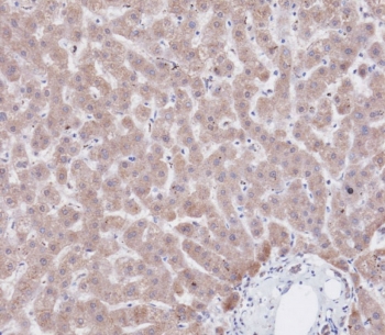 IHC testing of FFPE human liver tissue with CBS antibody. HIER: steam section in pH9 EDTA for 20 min and allow to cool prior to staining.