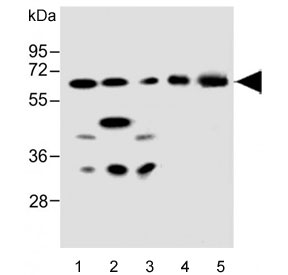 Western blot testing of human 1) Raji, 2) HeLa, 3) MCF7, 4) LNCaP, 5) human liver, 6) mouse liver and 7) mouse pancreas lysate with CBS antibody. Predicted molecular weight ~61 kDa.