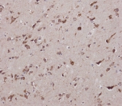 IHC testing of FFPE human brain tissue with CBS antibody. HIER: steam section in pH9 EDTA for 20 min and allow to cool prior to staining.