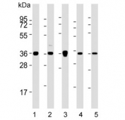 Western blot testing of 1) human HeLa, 2) human MCF7, 3) mouse NIH 3T3, 4) human SH-SY5Y and 5) human SK-BR-3 cell lysate with Annexin A2. Predicted molecular weight ~38 kDa.