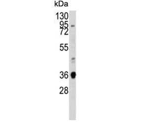 Western blot testing of mouse lung lysate with Annexin A2. Predicted molecular weight ~38 kDa.