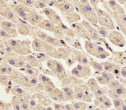 IHC testing of FFPE human liver tissue with Annexin A2 antibody. HIER: steam section in pH6 citrate buffer for 20 min and allow to cool prior to staining.