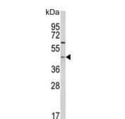 Western blot testing of human Jurkat cell lysate with PTAR1 antibody. Expected molecular weight: 46-50 kDa.