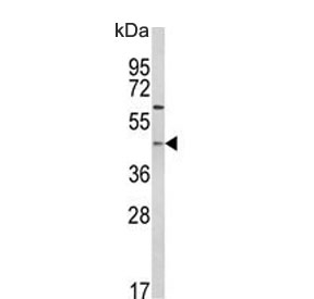 Western blot testing of human Jurkat cell lysate with PTAR1 antibody. Expected molecular weight: 46-50 kDa.