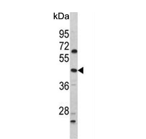 Western blot testing of human HL60 cell lysate with PTAR1 antibody. Expected molecular weight: 46-50 kDa.