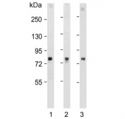 Western blot testing of human 1) plasma, 2) HeLa and 3) uterus lysate with Lactoferrin antibody. Predicted molecular weight: ~78 kDa (isoform 1) and ~73 kDa (isoforms 2).
