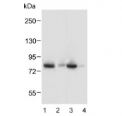 Western blot testing of human 1) plasma, 2) fetal kidney, 3) uterus and 4) skeletal muscle lysate with Lactoferrin antibody. Predicted molecular weight: ~78 kDa (isoform 1) and ~73 kDa (isoforms 2).