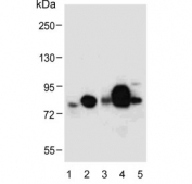 Western blot testing of human 1) A549, 2) plasma, 3) fetal kidney, 4) breast and 5) uterus lysate with Lactoferrin antibody. Predicted molecular weight: ~78 kDa (isoform 1) and ~73 kDa (isoforms 2).