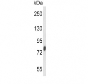 Western blot testing of mouse spleen lysate with Lactoferrin antibody. Predicted molecular weight: ~78 kDa (isoform 1) and ~73 kDa (isoforms 2).