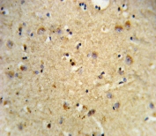IHC testing of FFPE human brain tissue with LOX-1 antibody. HIER: steam section in pH6 citrate buffer for 20 min and allow to cool prior to staining.