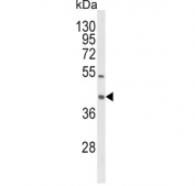 Western blot testing of human HL60 lysate with LOX-1 antibody. Predicted molecular weight: pro-form 35-50 kDa, mature form ~31 kDa.