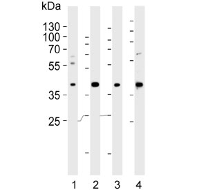 Western blot testing of human 1) A549, 2) HUVEC, 3) liver and 4) placenta lysate with LOX-1 antibody. Predicted molecular weight: pro-form 35-50 kDa, mature form ~31 kDa.
