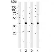 Western blot testing of human 1) A549, 2) HUVEC, 3) liver and 4) placenta lysate with LOX-1 antibody. Predicted molecular weight: pro-form 35-50 kDa, mature form ~31 kDa.
