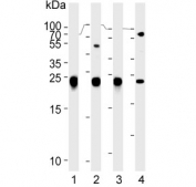 Western blot testing of human 1) K562, 2) PC-3, 3) Y79 and 4) mouse lung lysate with GST pi antibody. Predicted molecular weight ~23 kDa.