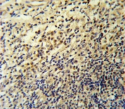 IHC testing of FFPE human tonsil tissue with Lp-PLA2 antibody. HIER: steam section in pH6 citrate buffer for 20 min and allow to cool prior to staining.