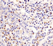 IHC testing of FFPE human tonsil tissue with Lp-PLA2 antibody. HIER: steam section in pH6 citrate buffer for 20 min and allow to cool prior to staining.