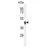 Western blot testing of human HL60 cell lysate with Lp-PLA2 antibody. Expected molecular weight: 45-67 kDa depending on glycosylation level.