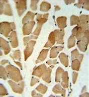 IHC testing of FFPE human skeletal muscle tissue with GLG1 antibody. HIER: steam section in pH6 citrate buffer for 20 min and allow to cool prior to staining.