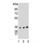 Western blot testing of human 1) HeLa, 2) Jurkat and 3) HL60 cell lysate with Thymidylate Synthase antibody. Predicted molecular weight ~36 kDa.
