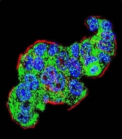 Immunofluorescent staining of fixed and permeabilized human WiDr cells with Thymidylate Synthase antibody (green), DAPI nuclear stain (blue) and anti-Actin (red).