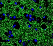 Immunofluorescent staining of human brain tissue with Synaptophysin antibody (green) and DAPI nuclear stain (blue).