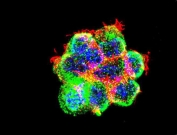 Immunofluorescent staining of fixed and permeabilized human 293 cells with Catenin Beta antibody (green), DAPI nuclear stain (blue) and anti-Actin (red).