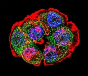 Immunofluorescent staining of fixed and permeabilized human T-47D cells with Catenin Beta antibody (green), DAPI nuclear stain (blue) and anti-Actin (red).