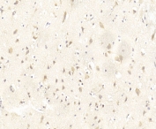 IHC testing of FFPE human brain tissue with Lingo1 antibody. HIER: steam section in pH6 citrate buffer for 20 min and allow to cool prior to staining.