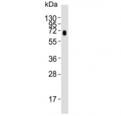 Western blot testing of human MDA-MB-231 cell lysate with CD73 antibody. Predicted molecular weight: 65-70 kDa.