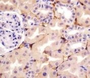 IHC testing of FFPE human kidney tissue with CD73 antibody. HIER: steam section in pH6 citrate buffer for 20 min and allow to cool prior to staining.