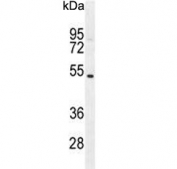Western blot testing of human MDA-MB-435 cell lysate with GFRAL antibody. Predicted molecular weight ~45 kDa.