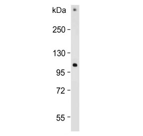 Western blot testing of human HACAT cell lysate with RHBDF2 antibody. Predicted molecular weight ~97 kDa.