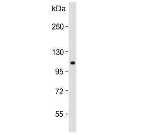 Western blot testing of mouse lung lysate with RHBDF2 antibody. Predicted molecular weight ~97 kDa.