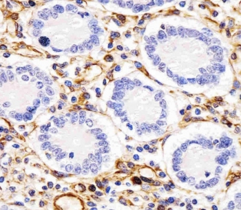IHC testing of FFPE human duodenum tissue with RHBDF2 antibody. HIER: steam section in pH6 citrate buffer for 20 min and allow to cool prior to staining.