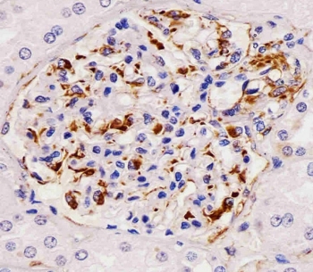 IHC testing of FFPE human kidney tissue with RHBDF2 antibody. HIER: steam section in pH6 citrate buffer for 20 min and allow to cool prior to staining.