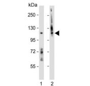 Western blot testing of human 1) A431 and 2) Caco-2 cell lysate with CD133 antibody. Predicted molecular weight: 97-130 kDa depending on glycosylation level.