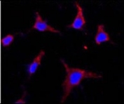 Immunofluorescent staining of fixed and permeabilized human HeLa cells with CD133 antibody (red) and DAPI nuclear stain (blue).