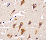 IHC testing of FFPE human brain tissue with Cyclophilin D antibody. HIER: steam section in pH6 citrate buffer for 20 min and allow to cool prior to staining.