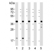 Western blot testing of human 1) K562, 2) HepG2, 3) Jurkat, 4) CCRF-CEM and 5) brain lysate with Cyclophilin D antibody. Predicted molecular weight: ~40 kDa