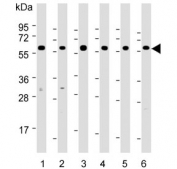 Western blot testing of human 1) HeLa, 2) MCF7, 3) HepG2, 4) Jurkat, 5) mouse NIH 3T3 and 6) mouse thymus lysate with Hsp60 antibody. Predicted molecular weight: ~60 kDa.