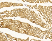 IHC testing of FFPE human myocardium tissue with Myosin Light Chain 2 antibody. HIER: steam section in pH6 citrate buffer for 20 min and allow to cool prior to staining.