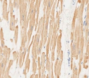IHC testing of FFPE human heart tissue with Myosin Light Chain 2 antibody. HIER: steam section in pH6 citrate buffer for 20 min and allow to cool prior to staining.