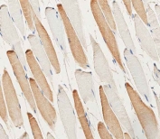 IHC testing of FFPE human skeletal muscle tissue with Myosin Light Chain 2 antibody. HIER: steam section in pH6 citrate buffer for 20 min and allow to cool prior to staining.