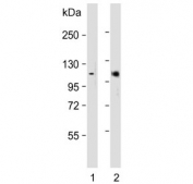 Western blot testing of 1) mouse eyeball and 2) rat eyeball lysate with Retinoblastoma antibody. Predicted molecular weight ~110 kDa.